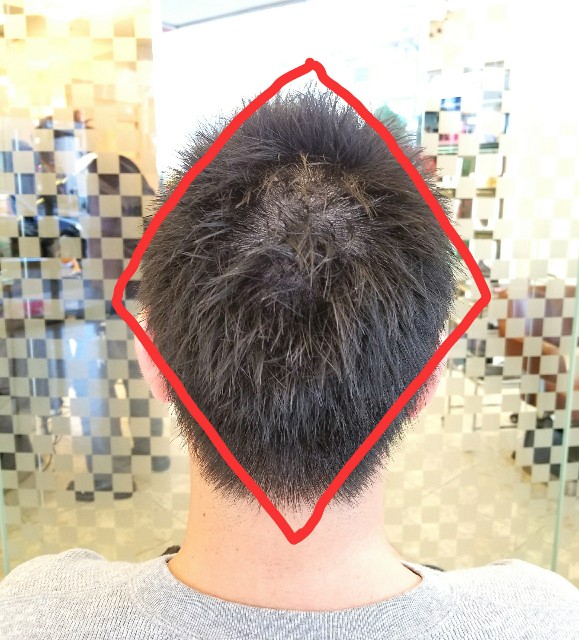 f:id:ami_tanaka:20171128222119j:image