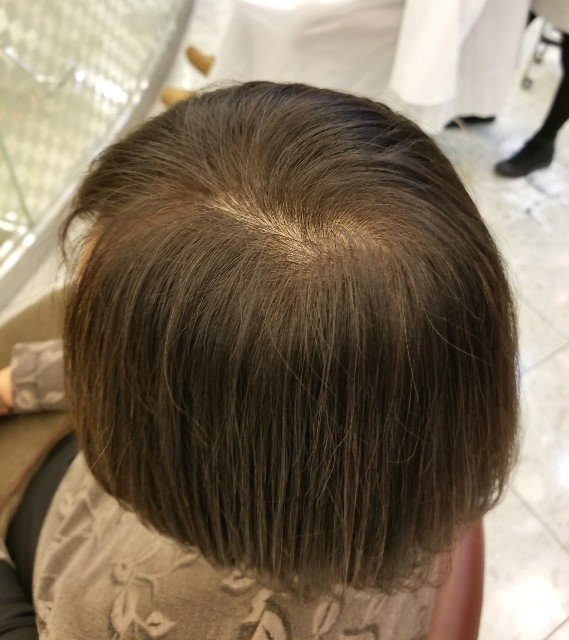 f:id:ami_tanaka:20171215211837j:image