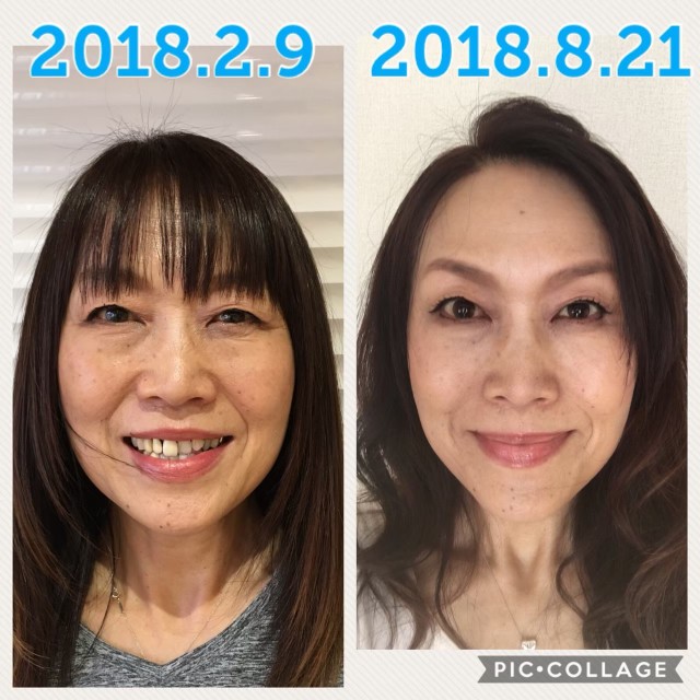 f:id:amii-kaoyoga61:20200301082500j:image