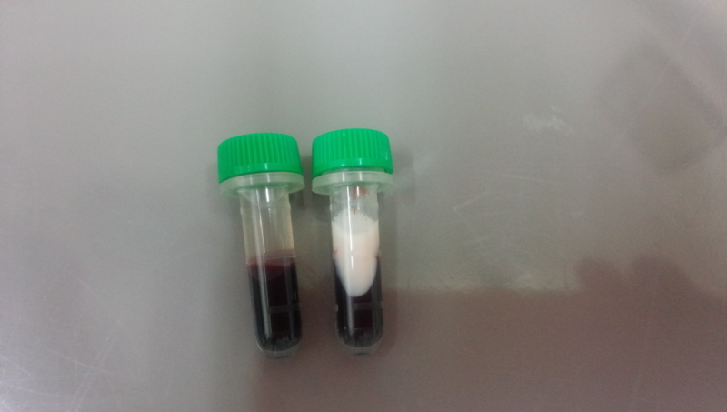 f:id:anbeto:20140314101424j:image:w360