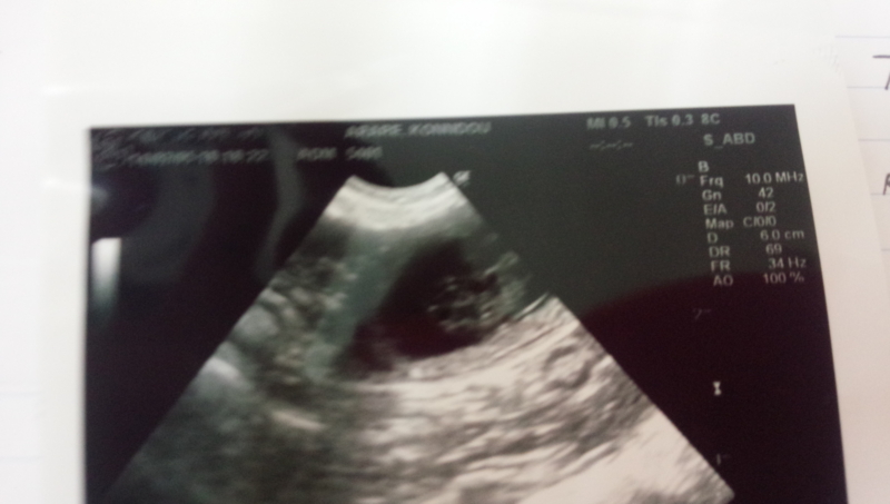 f:id:anbeto:20140329110532j:image:w360 f:id:anbeto:20140329110532j:image:w360
