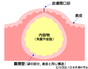 f:id:anbeto:20150131094012g:image:w360 f:id:anbeto:20150131094012g:image:w360