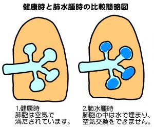 f:id:anbeto:20160903110524j:image:w360