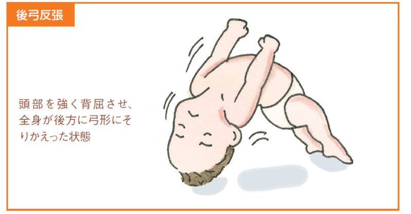 てんかん発作と失神の違い ベルどうぶつクリニックのﾌﾞﾛｸﾞ