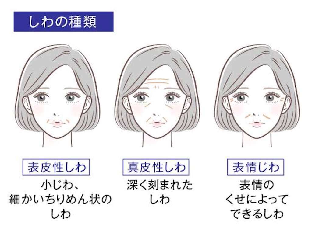 f:id:anchanC:20230310205330j:image