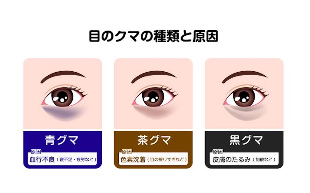 f:id:anchanC:20230312115034j:image