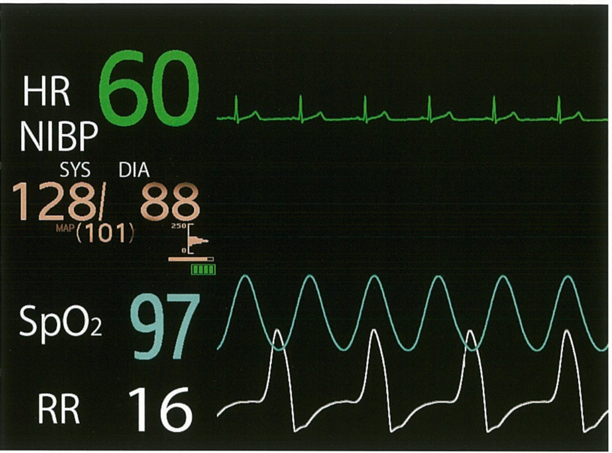 f:id:andQ:20200403213155p:plain f:id:andQ:20200403213155p:plain