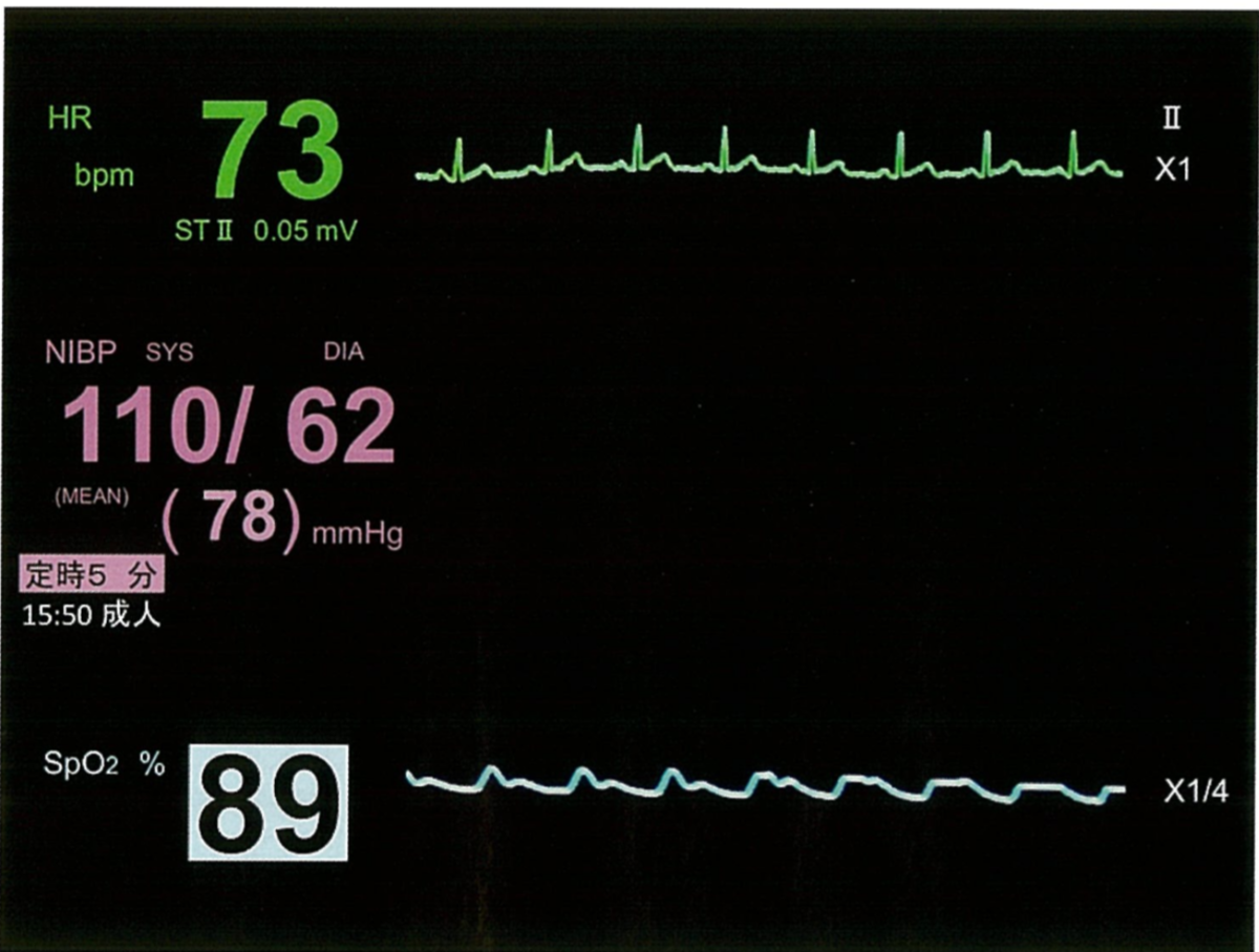 f:id:andQ:20200403213711p:plain f:id:andQ:20200403213711p:plain