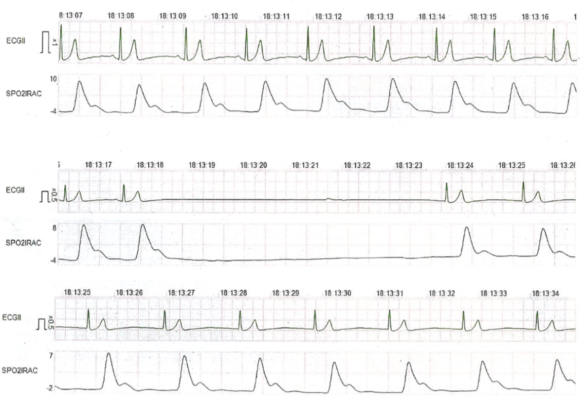 f:id:andQ:20200403214315p:plain f:id:andQ:20200403214315p:plain