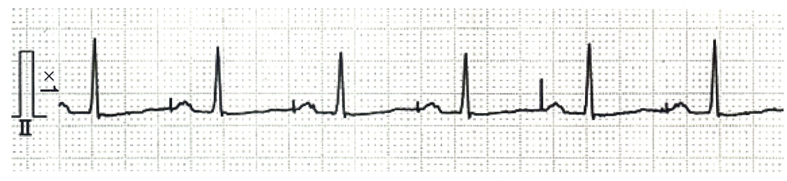 f:id:andQ:20200403215154p:plain f:id:andQ:20200403215154p:plain