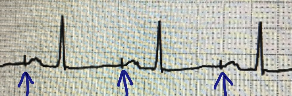 f:id:andQ:20200403215423j:plain f:id:andQ:20200403215423j:plain