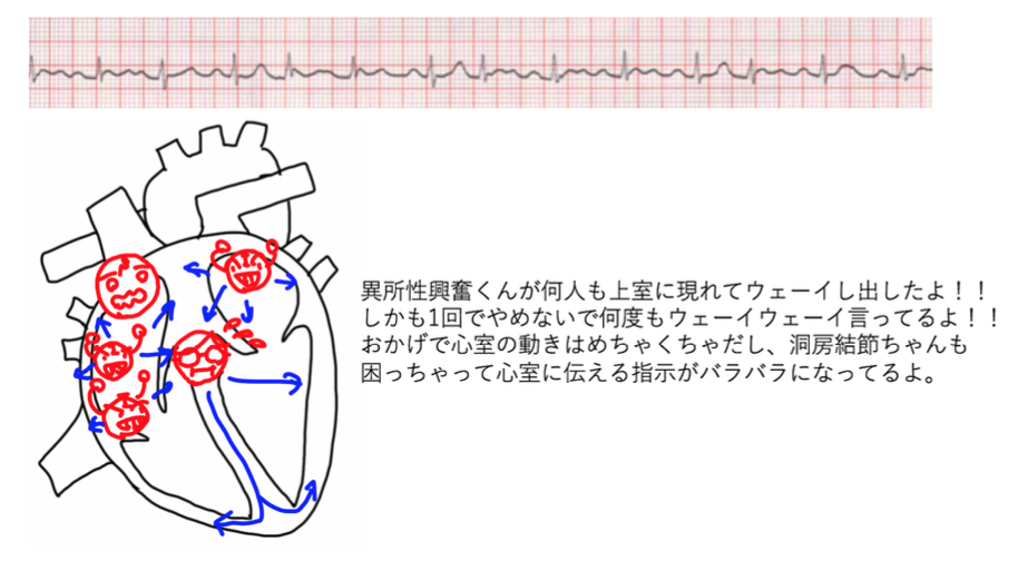 f:id:andQ:20200705003026p:plain f:id:andQ:20200705003026p:plain