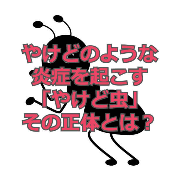 やけどのような炎症を起こす やけど虫 その正体とは ジョニラボ