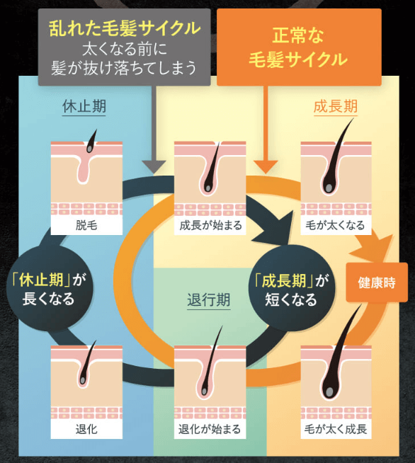 薄毛や抜毛は毛髪サイクルの乱れが原因