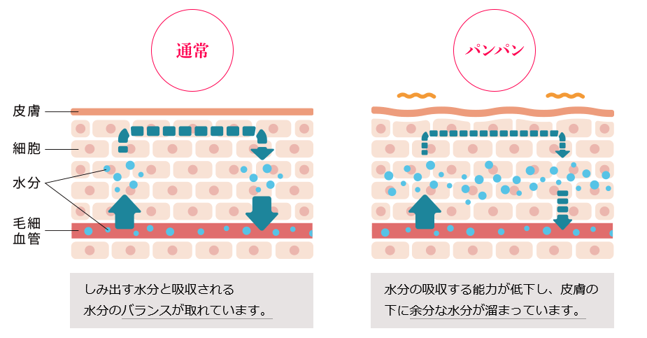 パンパンは余分な水分が原因