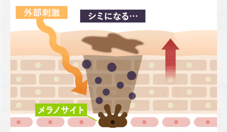 紫外線ダメージ