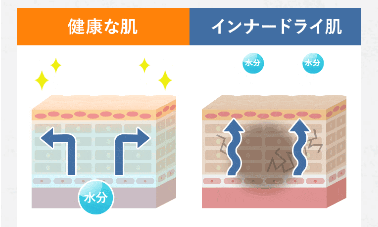 インナーケア不足