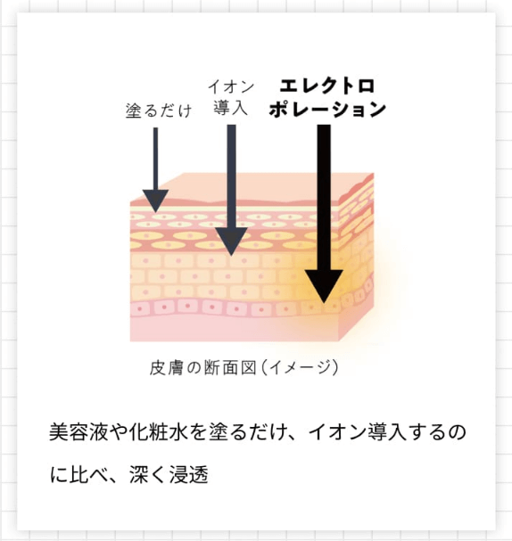 ワンスイーエムエスケアはエレクトロポレーション