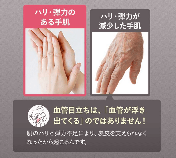 ピンテでハリと弾力のある手肌へ