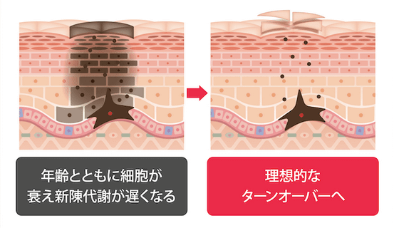 ナノポロンは肌のターンオーバーをサポート