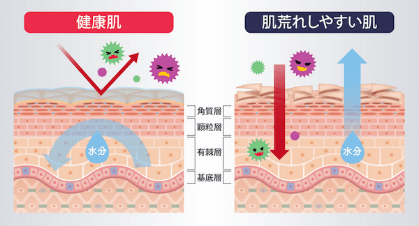 肌のターンオーバーの乱れ