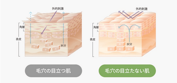 毛穴の悩みはランゲルハンス細胞の減少