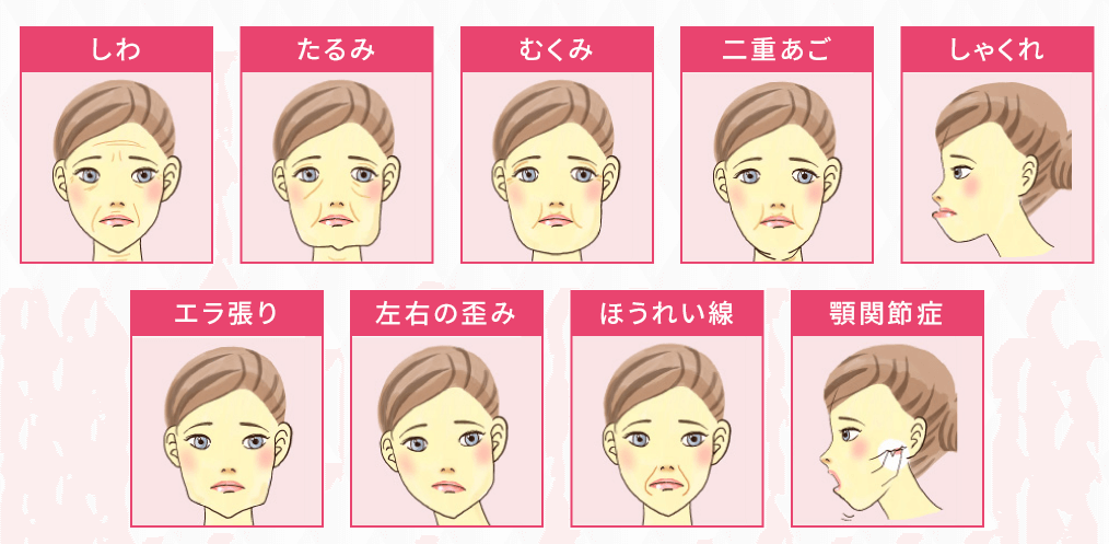 スピード小顔はお顔の不調