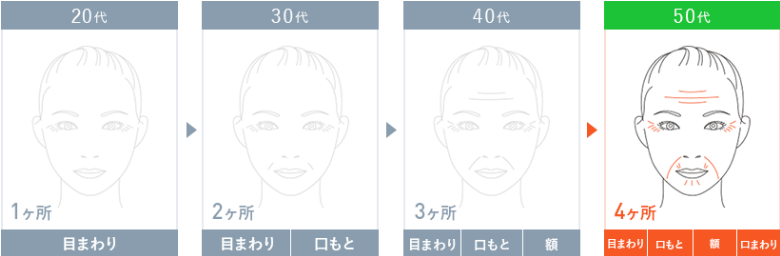 リンクルショットメディカルセラムNはこんな方にオススメ