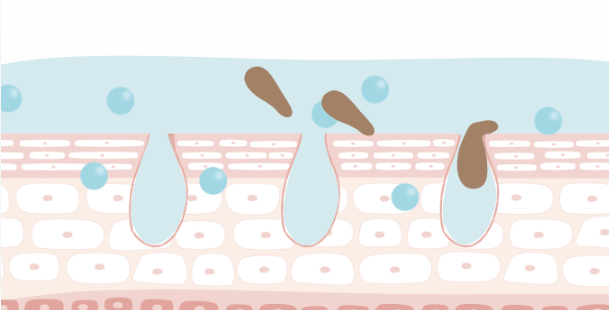 ソラハダクレンジングバームは毛穴の奥まで浸透