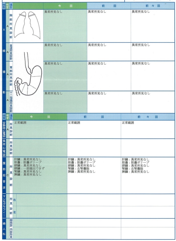 f:id:ank01453:20140614072329j:plain