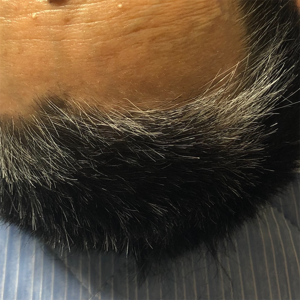 f:id:annesea:20210726200318j:image f:id:annesea:20210726200318j:image