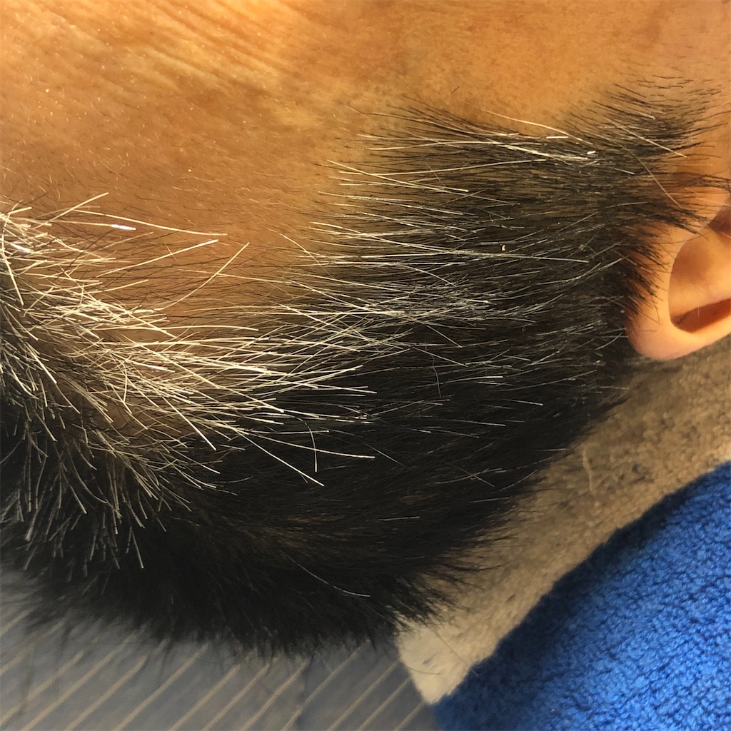 f:id:annesea:20210726200326j:image f:id:annesea:20210726200326j:image