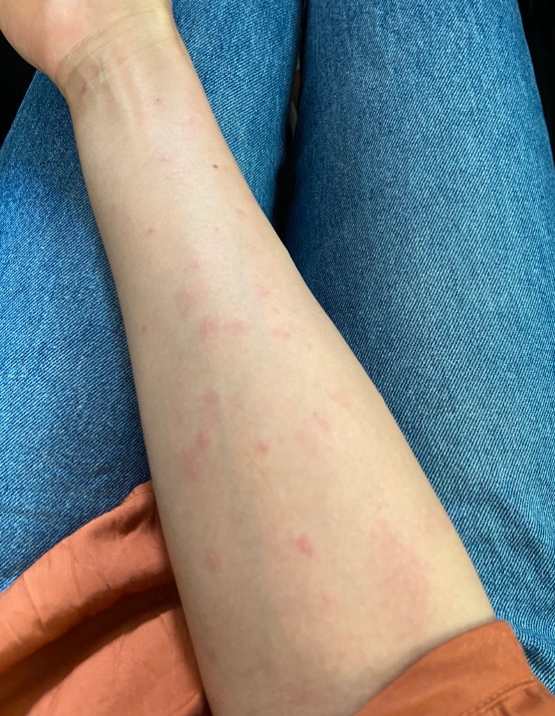 f:id:annkorokoror:20210810115135j:image f:id:annkorokoror:20210810115135j:image