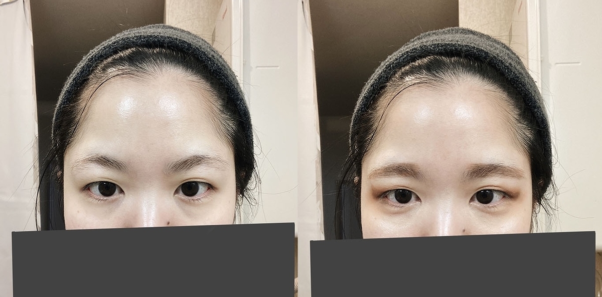 f:id:ant_arichan:20220318135406j:plain