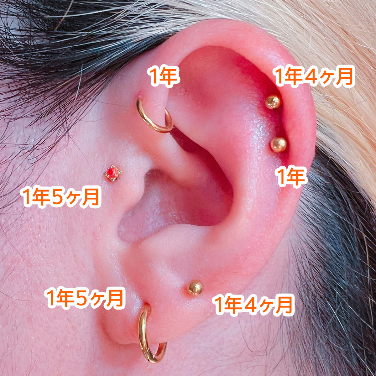 すべてのピアスホールがピアッシングから1年経ちました！現在の状況
