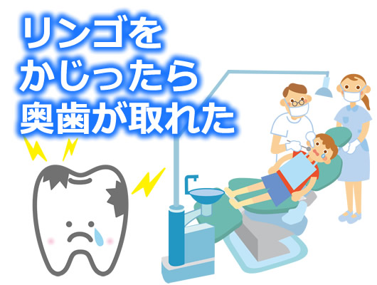 歯が取れたイメージ画像