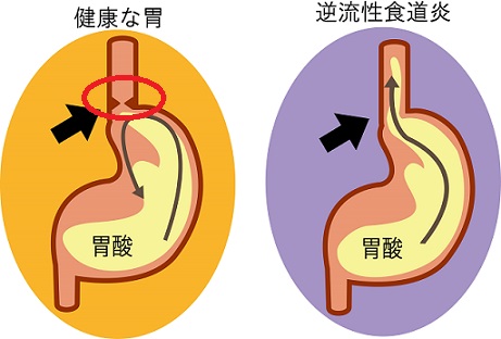 噴門の構造と役割