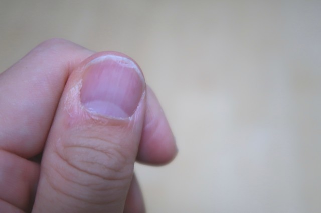 ビクトリノックスの爪切りを使って切る前の伸びた爪