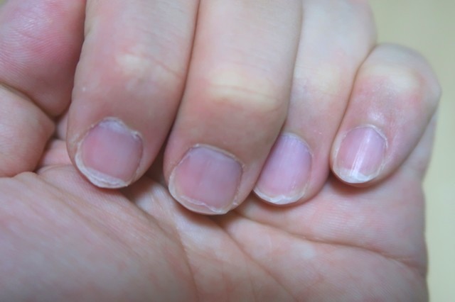 伸びた爪の様子の感想