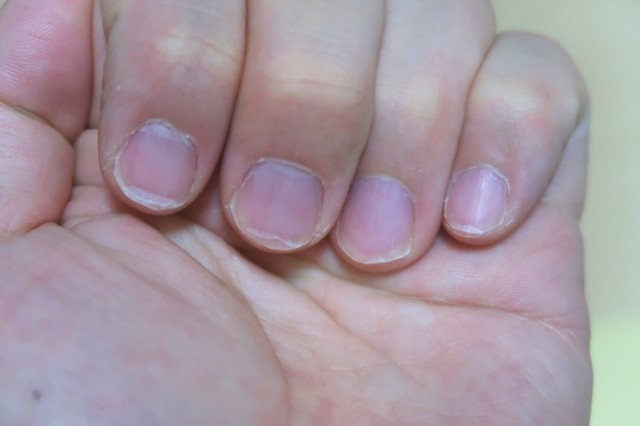 短く綺麗になった爪の様子