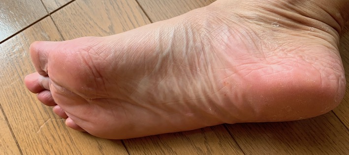 ガサガサかかとのお手入れ 削らない角質ケア ベビーフット を試した経過と結果 50歳 早期退職 のんびり楽しい暮らし