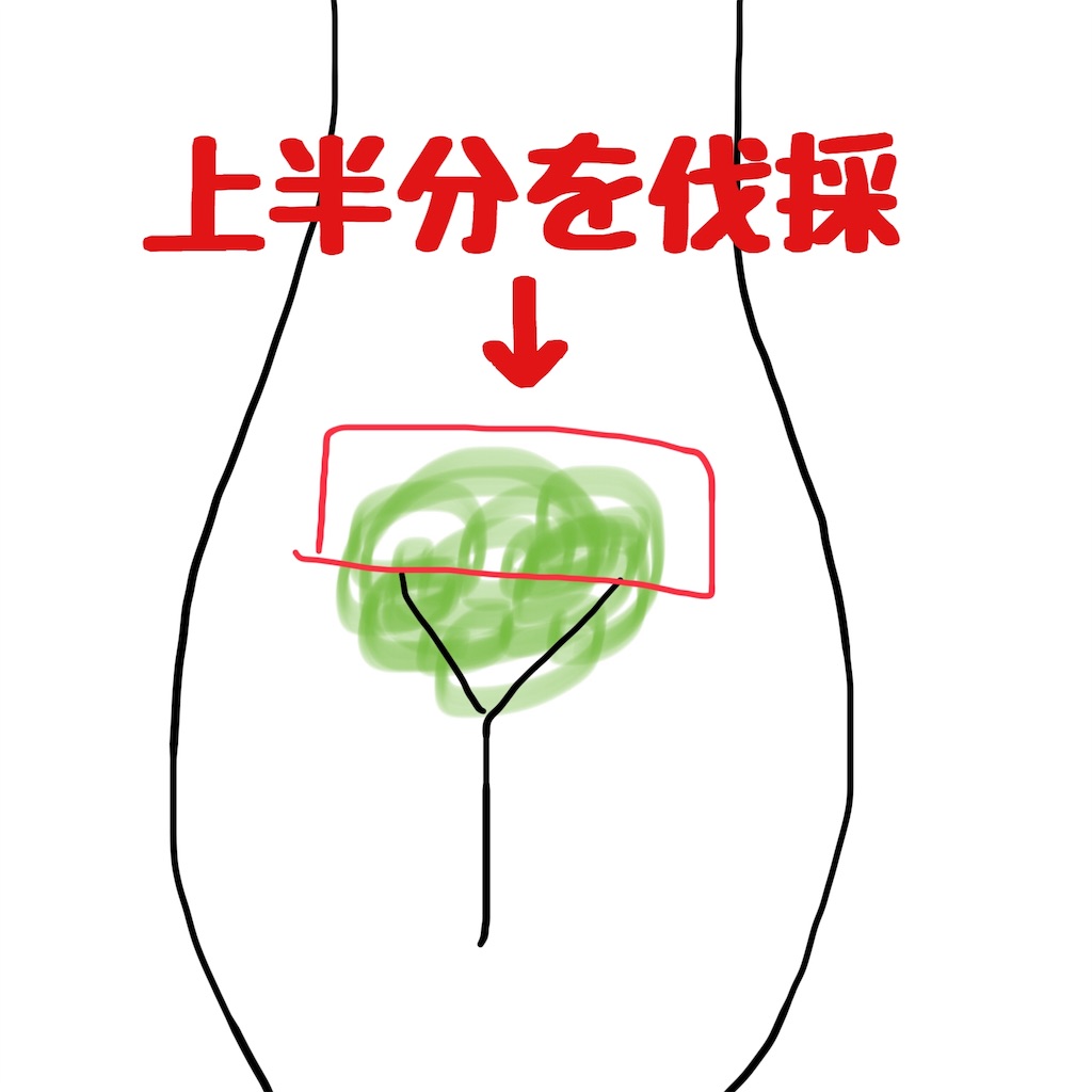 f:id:aooki:20200104001042j:image