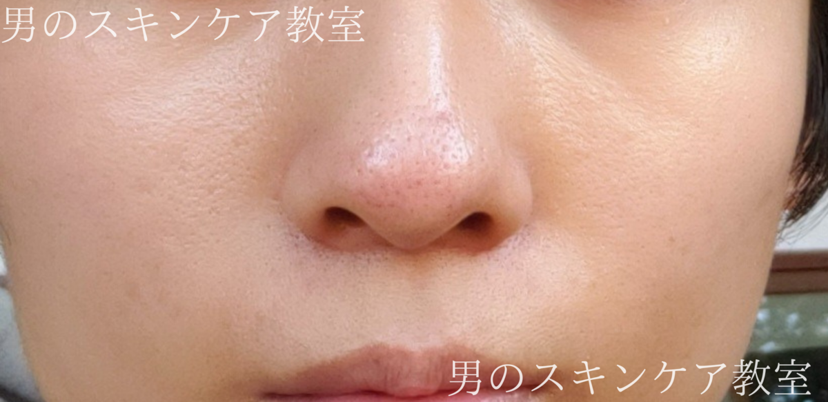 f:id:applecare:20210305094349p:plain