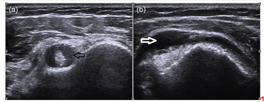 f:id:aquariusmedgim:20170328224507p:plain