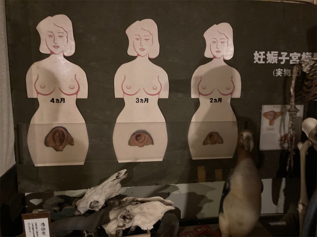 f:id:araguma:20221017131850j:image