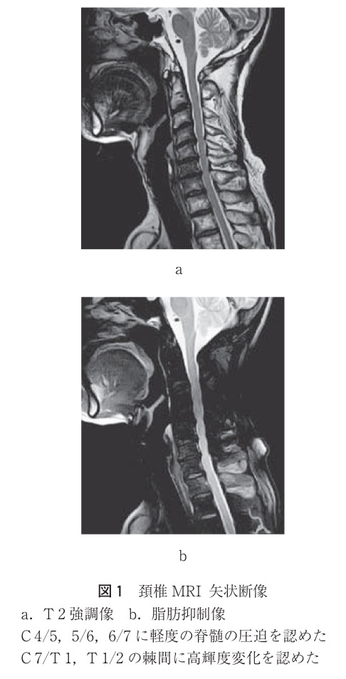 f:id:ararepyon:20190712061009p:plain f:id:ararepyon:20190712061009p:plain