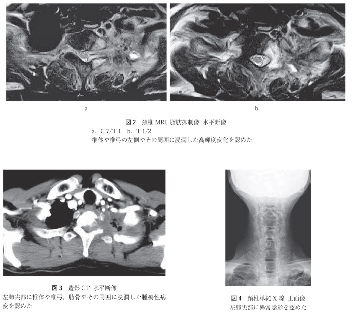 f:id:ararepyon:20190712061025p:plain f:id:ararepyon:20190712061025p:plain