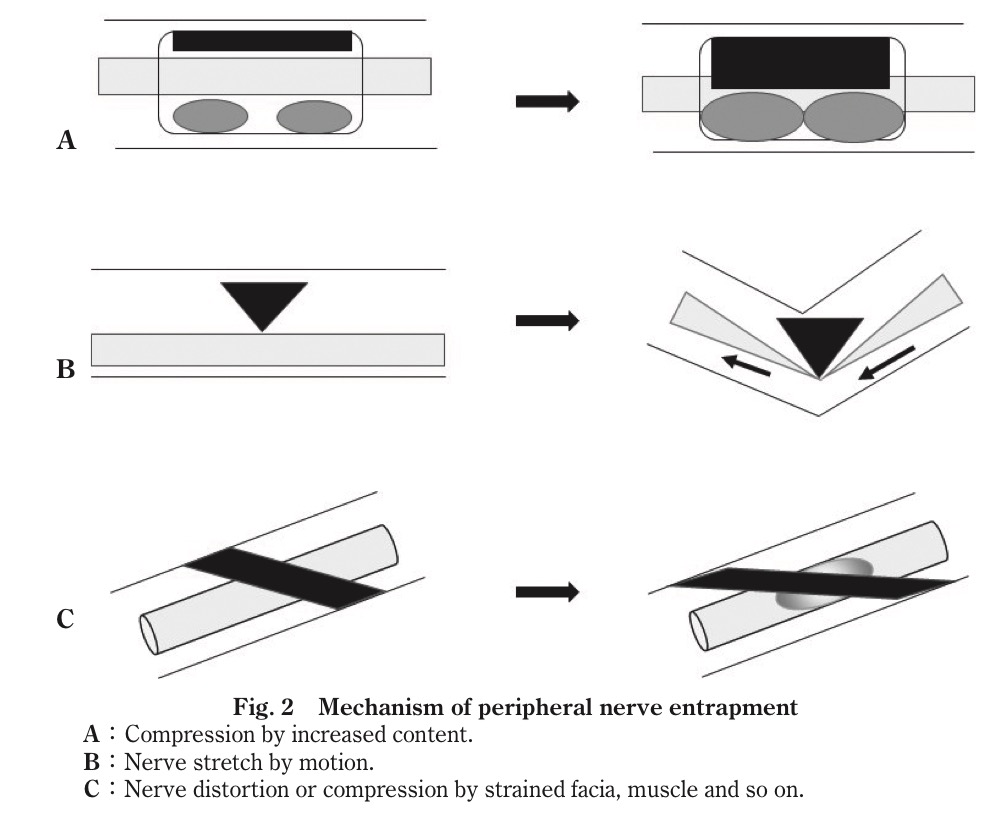 f:id:ararepyon:20190714063158p:plain f:id:ararepyon:20190714063158p:plain