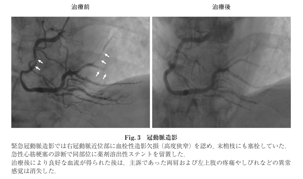 f:id:ararepyon:20190824072137p:plain f:id:ararepyon:20190824072137p:plain