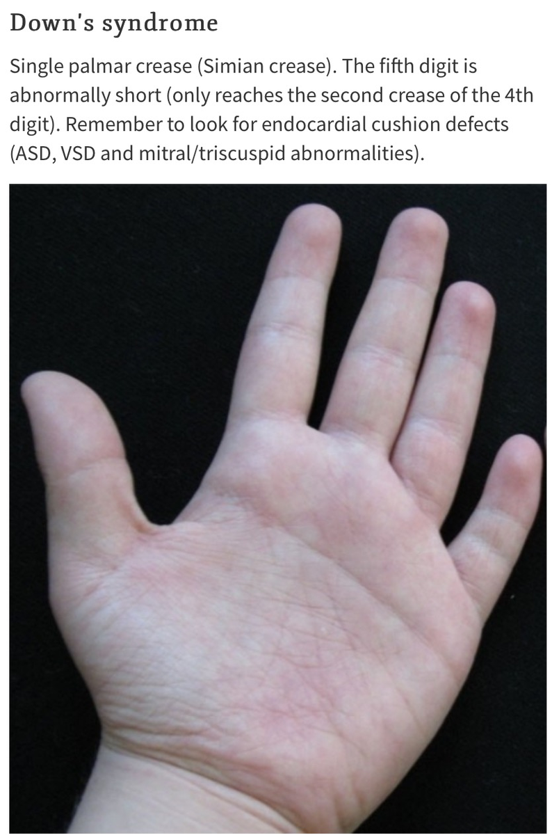 f:id:ararepyon:20191011092200p:plain f:id:ararepyon:20191011092200p:plain